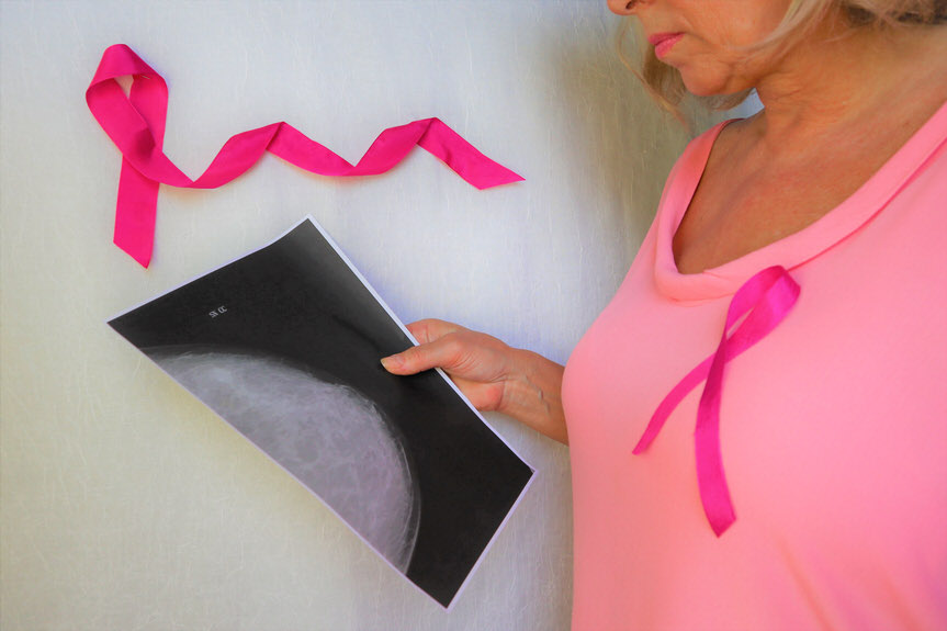 Gdzie kobiety mogą wykonać badania mammograficzne w mammobusach?