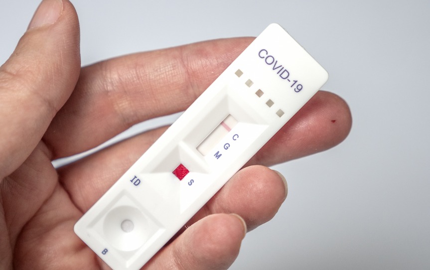 Od 1 kwietnia COVID-19 będzie traktowany jak grypa. Co musisz wiedzieć?
