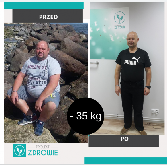 Pan Grzegorz schudł 35kg z Projekt Zdrowie w Krośnie!